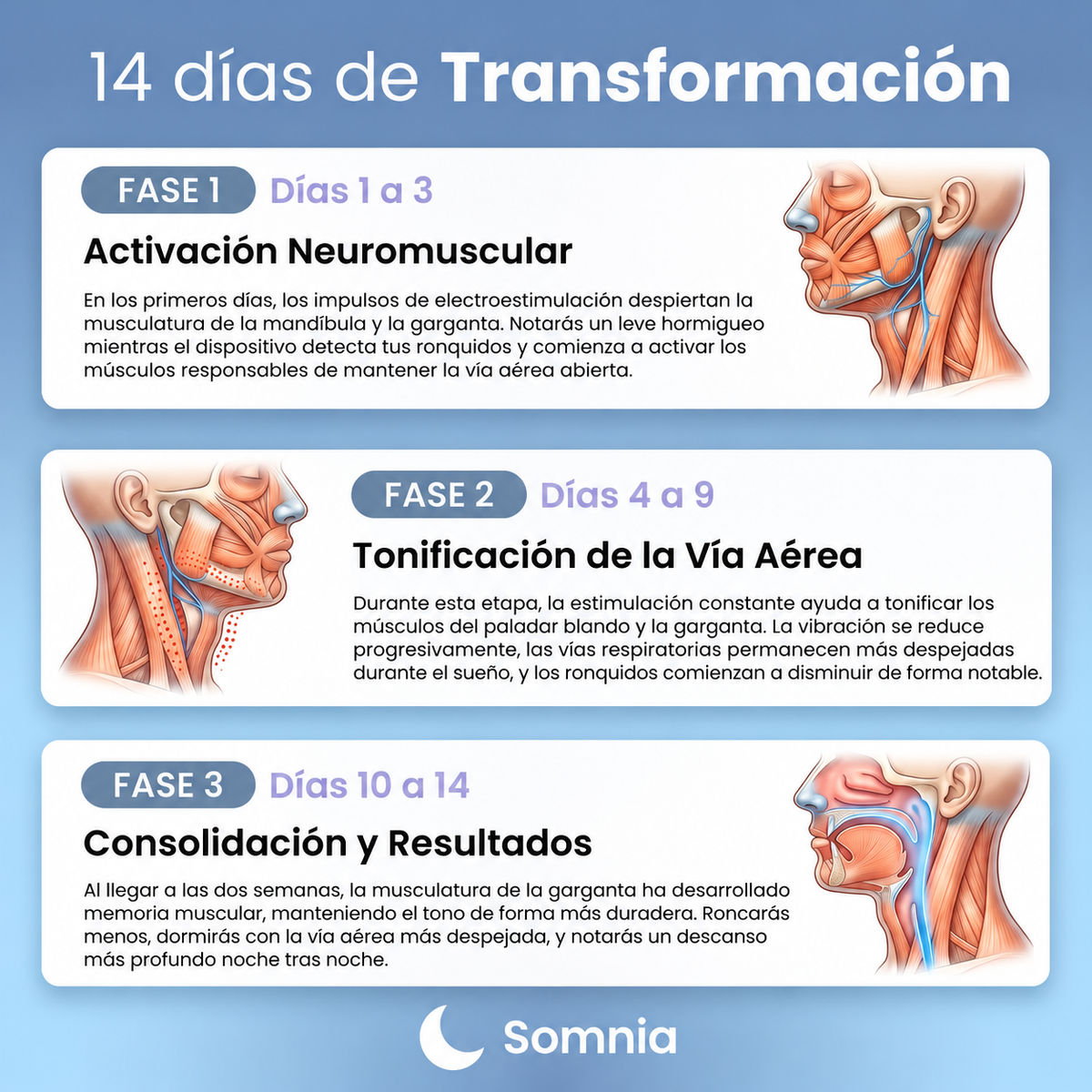Dispositivo Inteligente Anti-Ronquidos